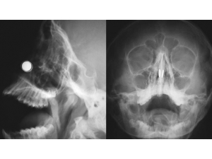 Türk Doktorlardan Literatüre Geçen Uygulama