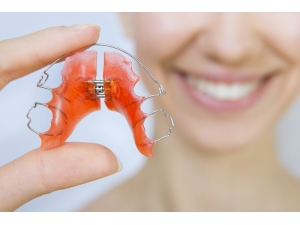 Ortodontide Telsiz Tedavi Mümkün Mü?