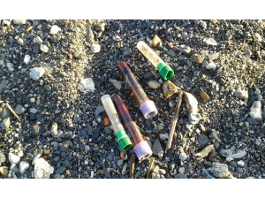 Sahile Vuran Tıbbi Atıklar Halkı Endişelendirdi