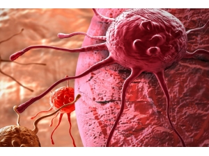 Doç. Dr. Ata: "Kanserin Tek Anahtarı ‘Erken Teşhis’ Değil"