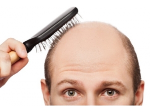 Uzmanlardan ’Saç Ektirmek Anlık Bir Karar Olmamalı’ Uyarısı