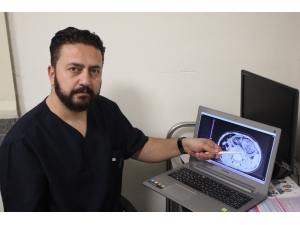 12 Yaşındaki Kızın Midesinden Top Büyüklüğünde Saç Ve Sakız Yumağı Çıkarıldı