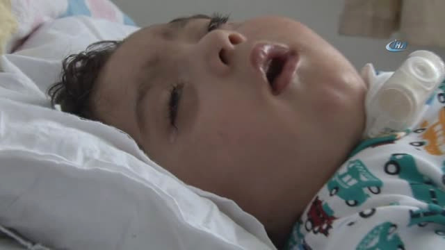 Havale Geçirip Yatağa Mahkum Olan Bebek, Kurtulmak İçin 1 Milyon Tl'lik Ameliyat Bekliyor
