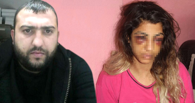 Barışmak İstemeyen Eşini Dövmüştü! Savcı, 'öldürmeye Teşebbüsten' 39 Yıl Hapis İstedi