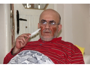 Yüzünde Çıkan Yaralar Nedeniyle Günden Güne Eriyor