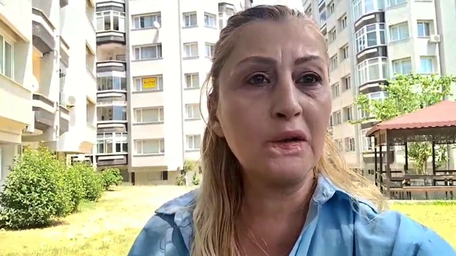 estetik-islem-sonrasi-dudagi-curudu-7-yildir-hukuk-mucadelesi-veriyor