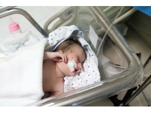 27 Günlük Bebeğe Göz Kapağı Yapıldı