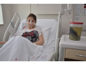 Midesinden 1.5 Kilogram Ağırlığında Saç Yumağı Çıktı