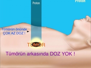Antalya’da Proton Kanser Tedavi Merkezi Kurulsun Önerisi
