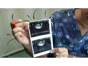 Stres Yüzünden 19 Yıl Çocuğu Olmadı