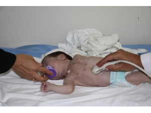 44 Günlük Bebeğin Kalbi Sağda Atıyor