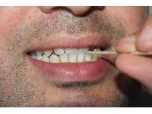 Diş Hekimlerinden ‘Kürdan’ Uyarısı