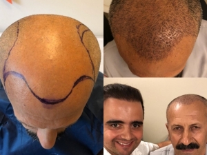 Kaybolan Yıllarına Bir Haftada Kavuştu