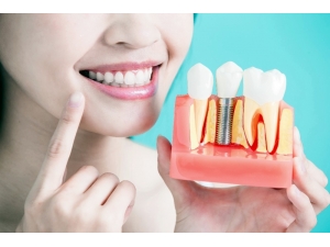 Suyu Seven Yeni İmplantla Elmayı Daha Güçlü Isırmak Mümkün