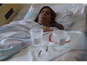 Vücudundaki İğneler 66 Yıl Sonra Çıkarıldı