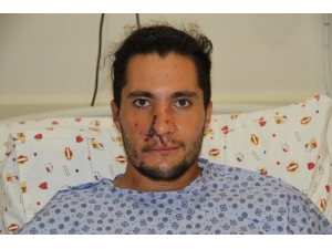 Alanya’da Kazada Burnu Kopan Rus Gence Kulağından Alınan Doku İle Burun Yapıldı