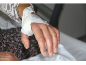 Kapalı Diyaliz Fistülü İlk Defa El Üstü Çukurundan Açıldı