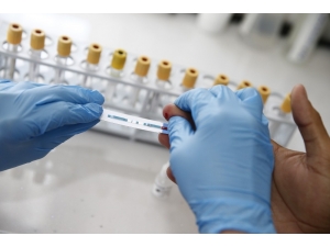 Konak Belediyesinden Ücretsiz Ve Anonim Hıv Testi