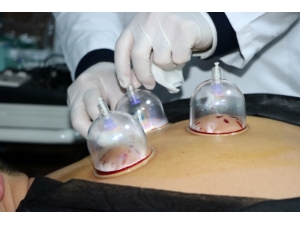 Sakarya’da Geleneksel Tamamlayıcı Tıp Uygulamasına İlgi Yoğun