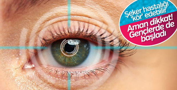 Diyabet Göz Hastalıklarını Tetikliyor