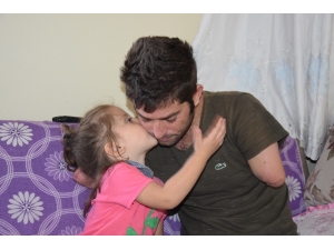 Kolları Ve Ayakları Kopan İşçi Protez İçin Yardım Bekliyor