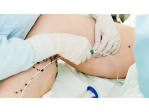 Varis Kadınlarda Daha Sık Görülüyor