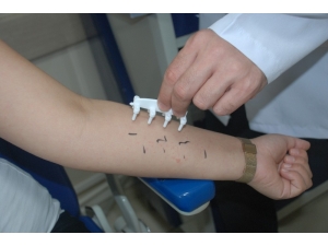 Alerjik Nezlede Yeni Nesil Test