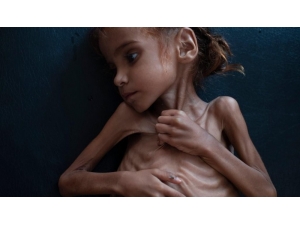 Kardeş Eli İnsani Yardım Derneği’nden Yemen İçin Acil Yardım Çağrısı