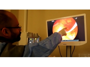 Kayseri Şehir Hastanesi’nden Ercp Hizmeti