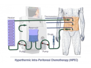 "İnsanları Gözle Görülemeyen Tümör Hücreleri Öldürüyor"