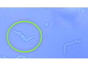 Gözünüzün Önünde Uçuşan Sineklere Dikkat