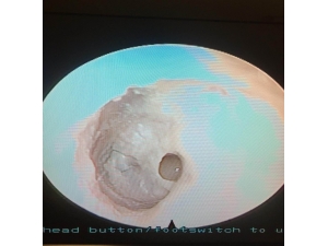 Kulak Zarındaki Delik, Salihli’de Onarıldı