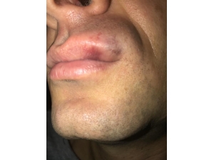 Hakem Camiasından Hakeme Kafa Atan Futbolcuya Tepki