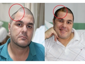 İki Fotoğraf Arasında İnanılmaz Fark