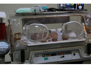 800 Gram Doğan Ömer Pusat Bebek 3 Santimetrelik Kesi İle Hayata Tutundu