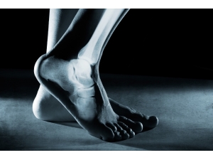 “Topuk Ağrısını Hafife Almayın”