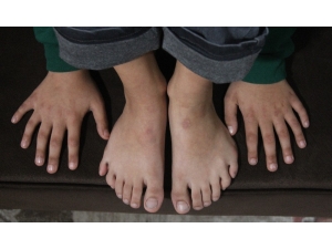 24 Parmaklı Çocuğun Ayakkabı Çilesi