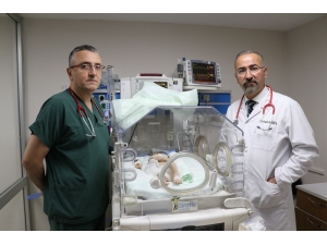 Kalbi Göbeğinde Olan Bebek Herkesi Şaşırttı