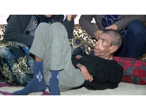 35 Yaşındaki Engelli Oğluna Bebek Gibi Bakıyor