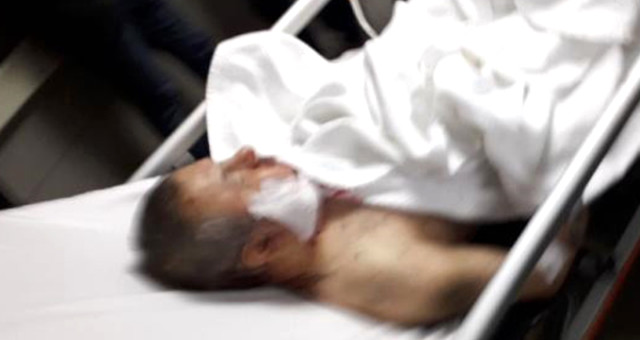 İyi Parti'den Aday Adayı Olan Hüsamettin Kul, Başından Bıçaklandı