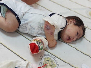 Yeni Doğan Kelebek Çocuklara Yardım