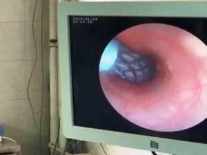 Türkiye’de İlk Kez Bir Köpeğe Stent Takıldı