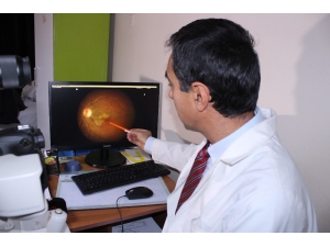 İzmir’de Akıl Almaz Olay: Kediden Bulaşan Parazit Gözlerini Kör Etti