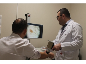 Deri Kanserinde Erken Tanı İmkanı