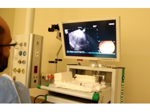 Kayseri Şehir Hastanesinde Eus Yöntemi Kullanılmaya Başlandı