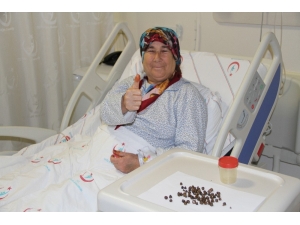 17 Yıldır Karın Ağrısı Çeken Kadının Safra Kesesinden 86 Parça Taş Çıkarıldı