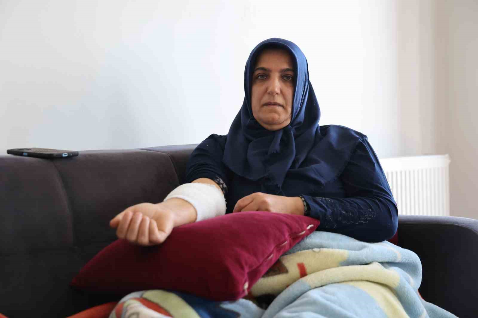 kopek-saldirisina-ugrayip-yaralanan-kadin-o-anlari-anlatti