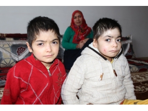 Kelebek Hastası Kardeşlerin Dramı Yürek Burkuyor