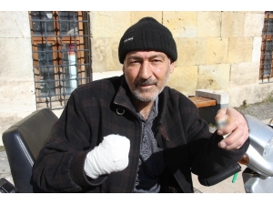 İki Ayağı Ve Bir Kolu Kesildi Yine Sigaradan Vazgeçmedi