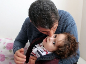 İki Bebeklerini Kaybeden Aile Üçüncü Bebekleri İçin ’Hidrosefali’ İle Mücadele Veriyor